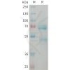 sp-PME101373 CCN2 Fig.1 SDS PAGE 1