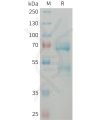 sp-PME101373 CCN2 Fig.1 SDS PAGE 1