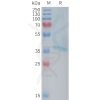 sp-PME101377 RAMP1 Fig.1 SDS PAGE 1