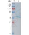 sp-PME101377 RAMP1 Fig.1 SDS PAGE 1