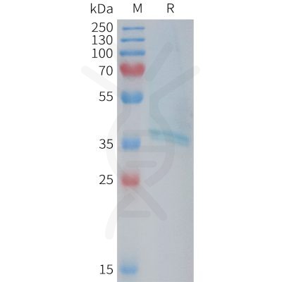 sp-PME101377 RAMP1 Fig.1 SDS PAGE 1