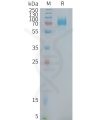sp-PME101380 CD22 Fig.1 SDS PAGE 1