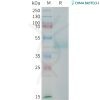 sp-PME101384 CDH17 Fig.1 SDS PAGE 1