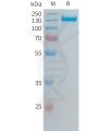 sp-PME101386 ITGAVITGB6 Fig.1 SDS PAGE 1