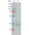 sp-PME101388 PRLR Fig.1 SDS PAGE 1