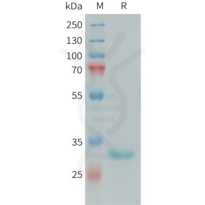 sp-PME101392 FCN1 Fig.1 SDS PAGE 1