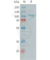 sp-PME101394 C1S Fig.1 SDS PAGE 1