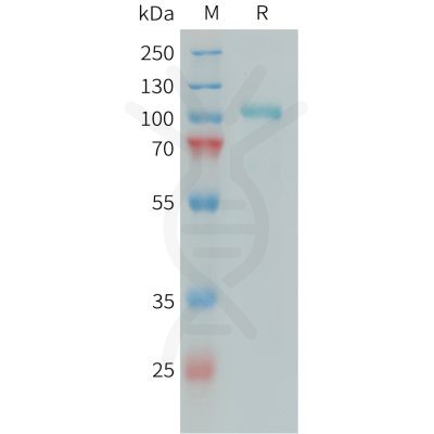 sp-PME101394 C1S Fig.1 SDS PAGE 1