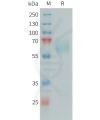 sp-PME101395 PSAP Fig.1 SDS PAGE 1