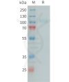 sp-PME101396 CFI Fig.1 SDS PAGE 1
