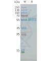 sp-PME101398 PLA2R1 Fig.1 SDS PAGE 1