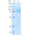 sp-PME101401 ADGRE5 Fig.1 SDS PAGE 1