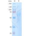 sp-PME101402 TIM4 Fig.1 SDS PAGE 1