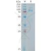 sp-PME101405 MET Fig.1 SDS PAGE 1