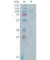 sp-PME101406 IL31RA Fig.1 SDS PAGE 1