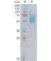 sp-PME101408 FGFR2IIIb Fig.1 SDS PAGE 1