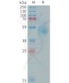 sp-PME101412 HER3 Fig.1 SDS PAGE 1