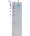sp-PME101413 ADGRD1 Fig.1 SDS PAGE 1