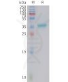 sp-PME101414 GAL Fig.1 SDS PAGE 1