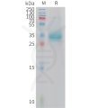 sp-PME101415 APOA2 Fig.1 SDS PAGE 1