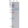 sp-PME101417 LEP Fig.1 SDS PAGE 1