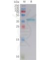 sp-PME101417 LEP Fig.1 SDS PAGE 1
