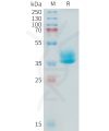sp-PME101418 ADAM17 Fig.1 SDS PAGE 1