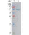 sp-PME101419 CRCP Fig.1 SDS PAGE 1