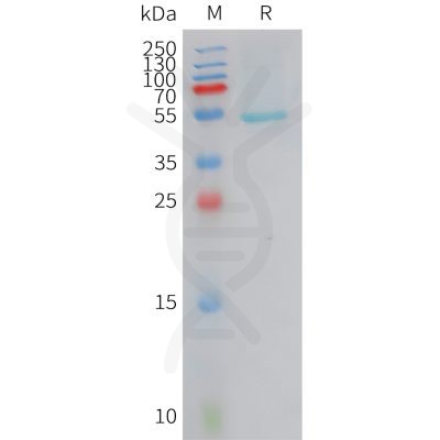 sp-PME101419 CRCP Fig.1 SDS PAGE 1