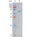 sp-PME101421 CCL5 Fig.1 SDS PAGE 1