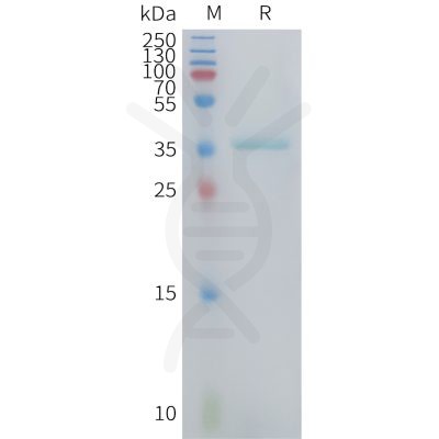 sp-PME101422 CCL3 Fig.1 SDS PAGE 1