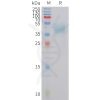 sp-PME101425 MC4R Fig.1 SDS PAGE 1