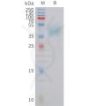 sp-PME101425 MC4R Fig.1 SDS PAGE 1
