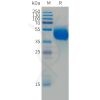 sp-PME101493 FCRL5 Fig.1 SDS PAGE 1