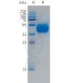 sp-PME101494 FCRL5 Fig.1 SDS PAGE 1
