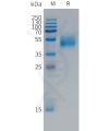 sp-PME101495 FCRL5 Fig.1 SDS PAGE 1