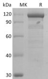 sp-PME30001 C06D P56704 SDS PAGE 0