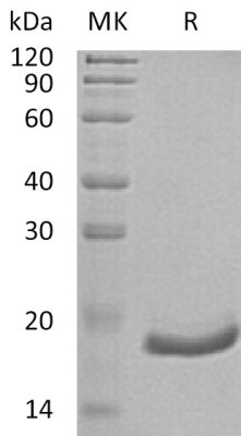 sp-PME30020 C662 P05013 SDS PAGE 0