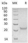 sp-PME30055 CC87 P05000 SDS PAGE 0