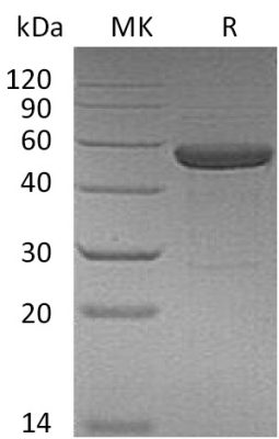 sp-PME30072 CK94 Q13261P40933 SDS PAGE 0