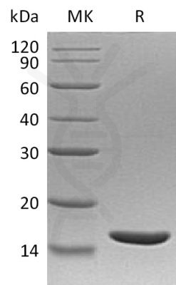 sp-PME30085 C181 P01374 SDS PAGE 0