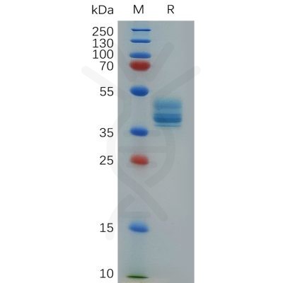 sp-pme c100008 anxa2 sp1