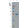 sp-pme c100011 btn3a1 sp1