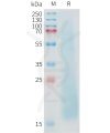 sp-pme c100026 muc1 sp1