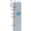 sp-pme c100039 mesothelin sp1