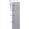 sp-pme c100050 cldn18.2 sp1