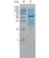 sp-pme c100054 cd3d and cd3e sp1