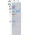 sp-pme c100057 trop2 sp1