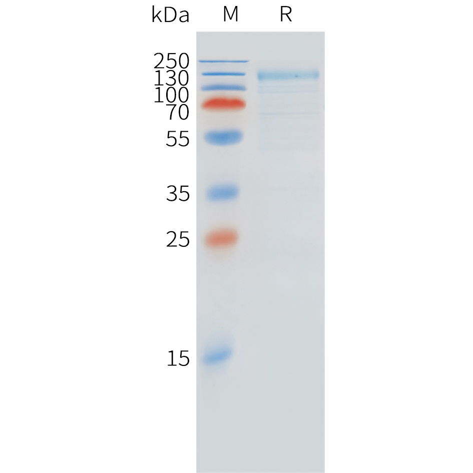 pme-c100061-fcrl5-sp1.jpg