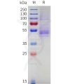 sp-pme c100086 nkg2a sp1